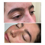 Blemish Control AHA 20%